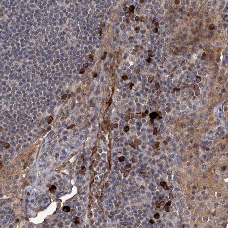 G2A/GPR132 Antibody - BSA Free Immunohistochemistry-Paraffin: G2A/GPR132 Antibody - BSA Free [NBP1-89807]