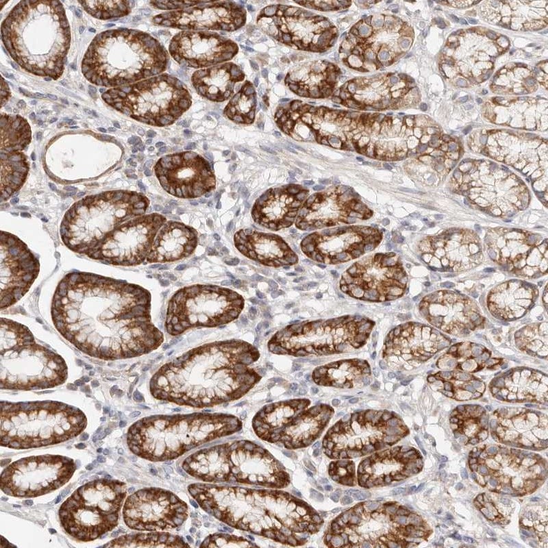 G protein alpha-13 Antibody - BSA Free Immunohistochemistry-Paraffin: G protein alpha-13 Antibody [NBP1-89810]
