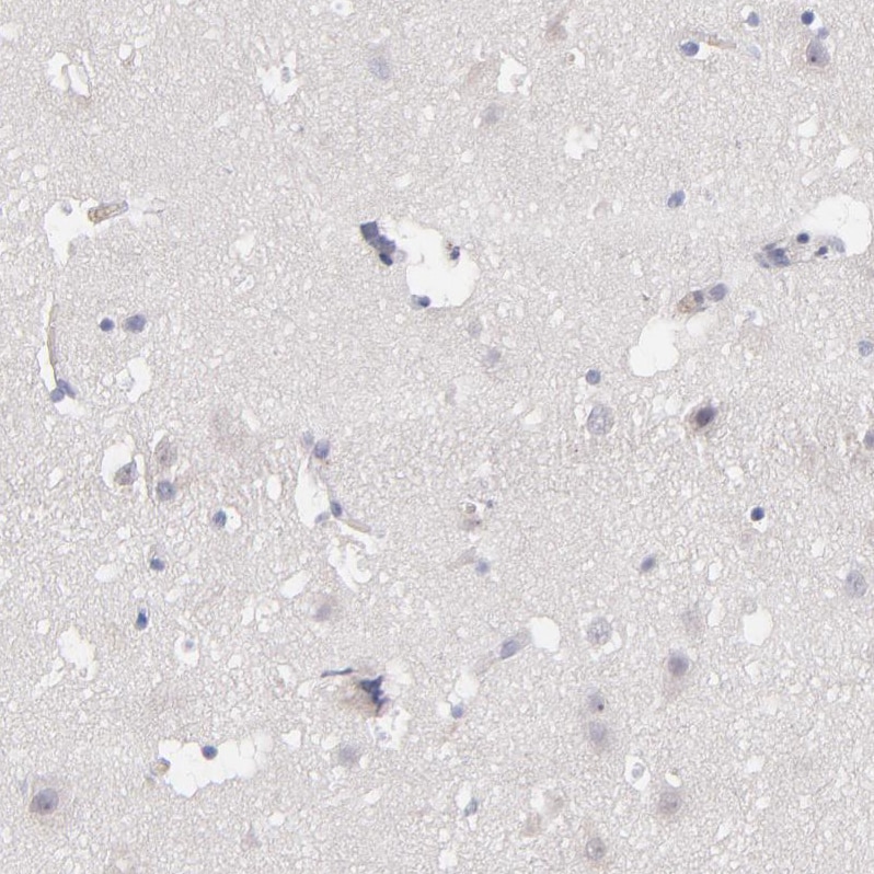 Factor XIIIb Antibody - BSA Free Immunohistochemistry-Paraffin: Factor XIIIb Antibody - BSA Free [NBP1-89811]