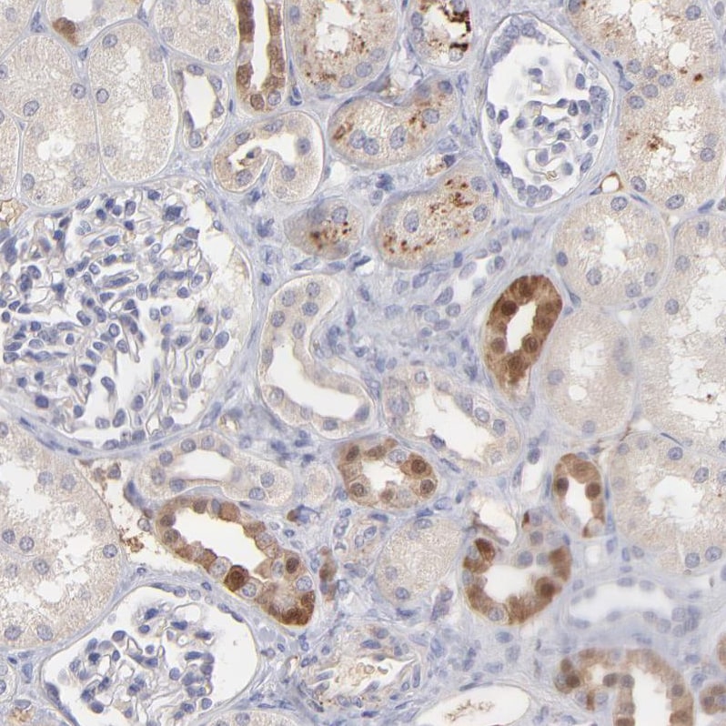 Factor XIIIb Antibody - BSA Free Immunohistochemistry-Paraffin: Factor XIIIb Antibody - BSA Free [NBP1-89811]