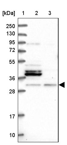 FUS2 Antibody - BSA Free Western Blot: FUS2 Antibody - BSA Free [NBP1-89812]