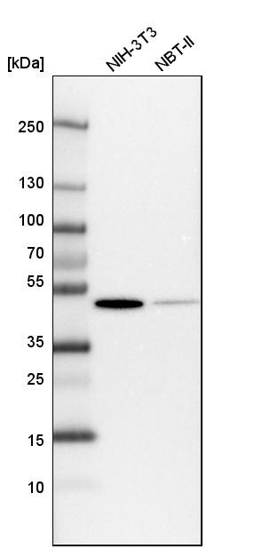 Fumarase Antibody - BSA Free Western Blot: Fumarase Antibody - BSA Free [NBP1-89814]