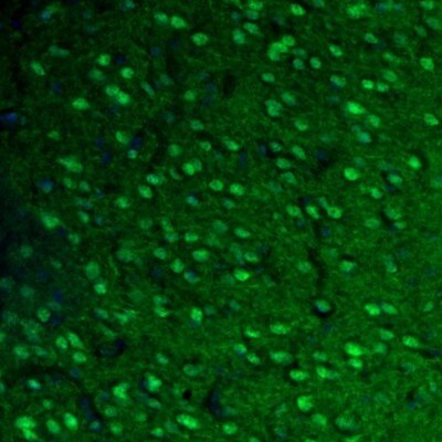 Fumarase Antibody