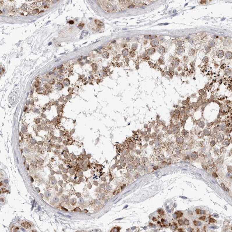 Fumarase Antibody