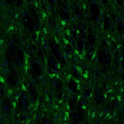 Fumarase Antibody