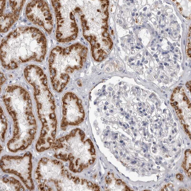 Fumarase Antibody