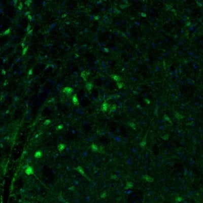 Fumarase Antibody