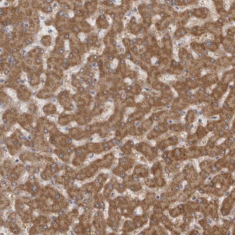 Fumarase Antibody