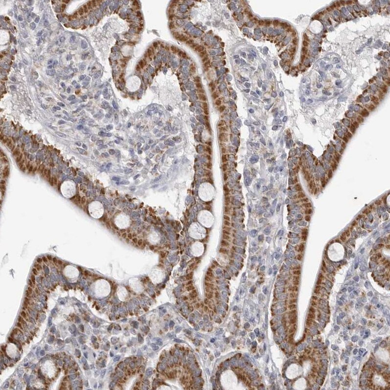 Fumarase Antibody