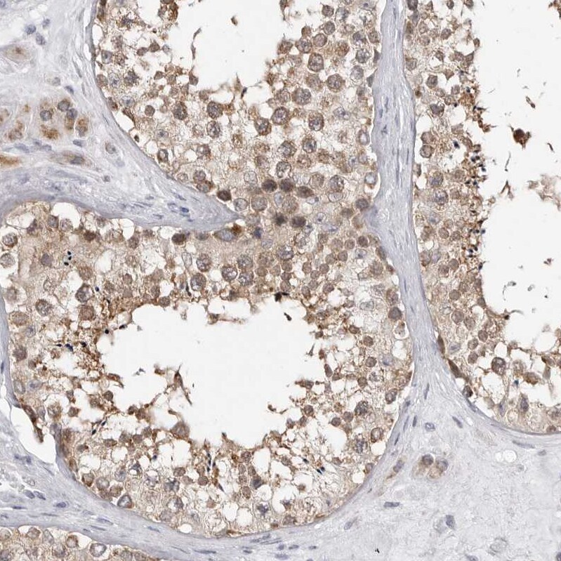 Fumarase Antibody - BSA Free Immunohistochemistry-Paraffin: Fumarase Antibody - BSA Free [NBP1-89815]