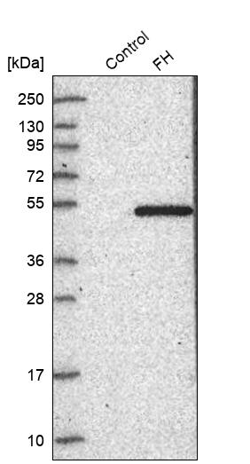 Fumarase Antibody - BSA Free Western Blot: Fumarase Antibody - BSA Free [NBP1-89815]