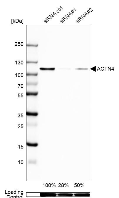 Alpha Actinin 4 Antibody - BSA Free Western Blot: Alpha Actinin 4 Antibody - BSA Free [NBP1-89818]
