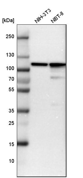 Alpha Actinin 4 Antibody - BSA Free Western Blot: Alpha Actinin 4 Antibody - BSA Free [NBP1-89818]