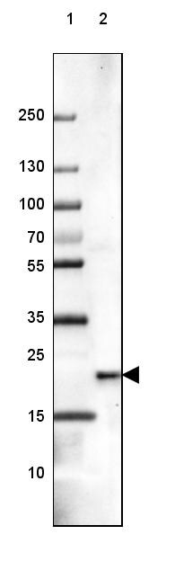 Frequenin Antibody - BSA Free Western Blot: Frequenin Antibody - BSA Free [NBP1-89820]