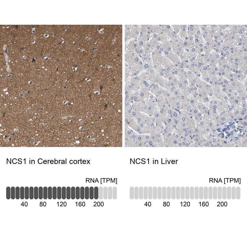 Frequenin Antibody - BSA Free Immunohistochemistry-Paraffin: Frequenin Antibody - BSA Free [NBP1-89820]