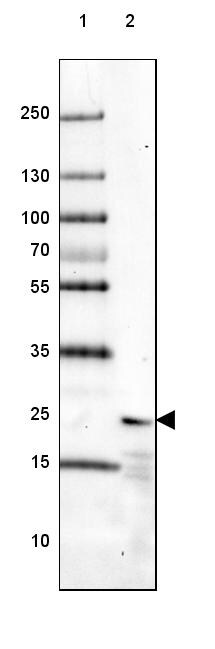 Frequenin Antibody - BSA Free Western Blot: Frequenin Antibody - BSA Free [NBP1-89820]