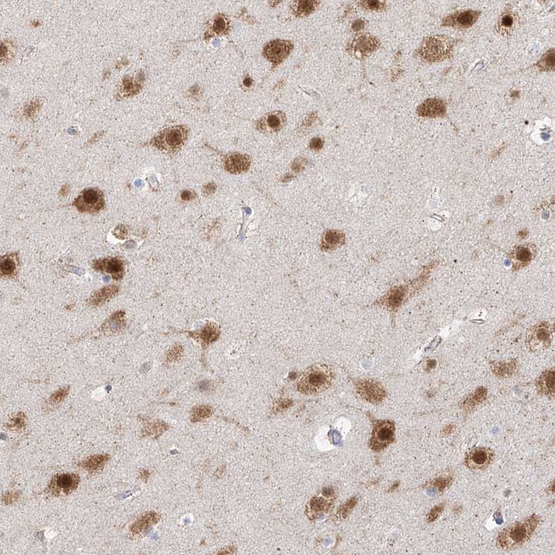 RBFOX3/NeuN Antibody - BSA Free Immunohistochemistry-Paraffin: RBFOX3/NeuN Antibody - BSA Free [NBP1-89821]