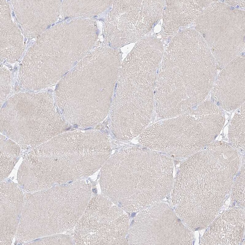 RBFOX3/NeuN Antibody - BSA Free Immunohistochemistry-Paraffin: RBFOX3/NeuN Antibody - BSA Free [NBP1-89821]