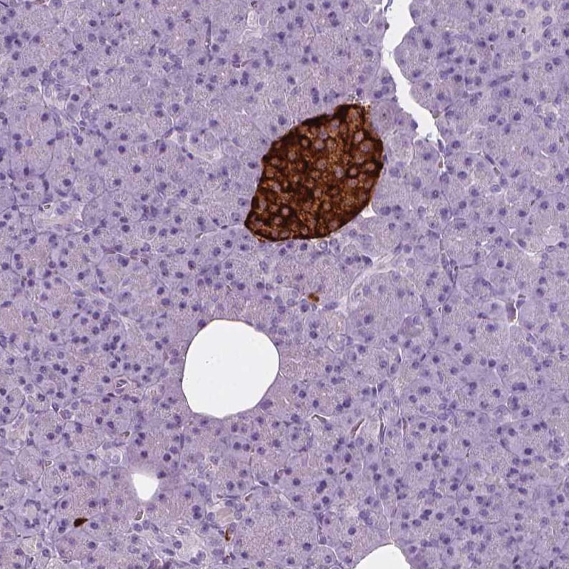 Secretogranin 3 Antibody - BSA Free Immunohistochemistry-Paraffin: Secretogranin 3 Antibody - BSA Free [NBP1-89825]