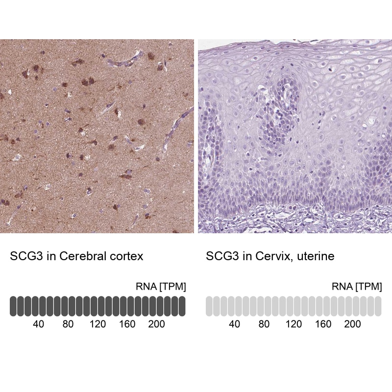 Secretogranin 3 Antibody - BSA Free Immunohistochemistry-Paraffin: Secretogranin 3 Antibody - BSA Free [NBP1-89825]