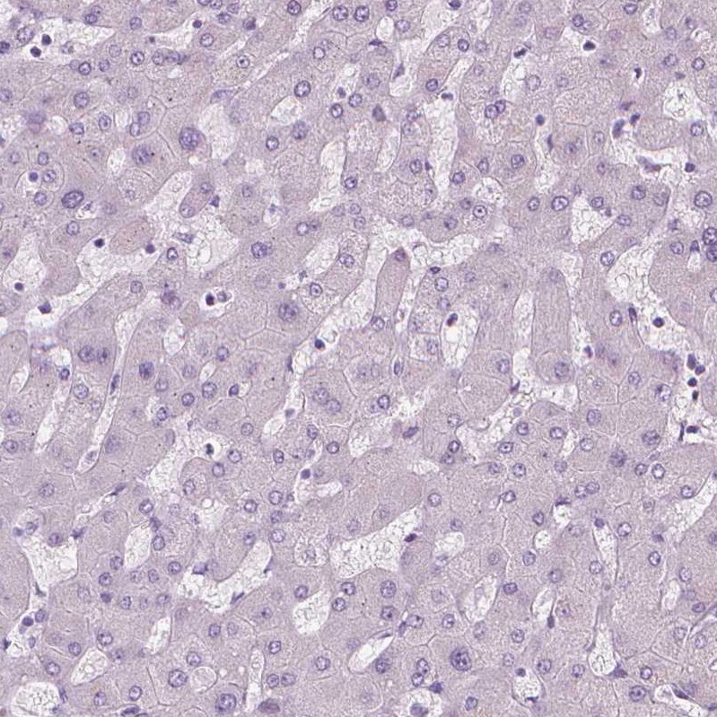 Secretogranin 3 Antibody - BSA Free Immunohistochemistry-Paraffin: Secretogranin 3 Antibody - BSA Free [NBP1-89825]