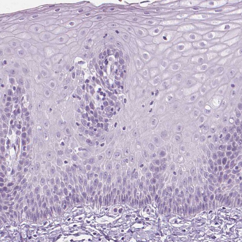 Secretogranin 3 Antibody - BSA Free Immunohistochemistry-Paraffin: Secretogranin 3 Antibody - BSA Free [NBP1-89825]