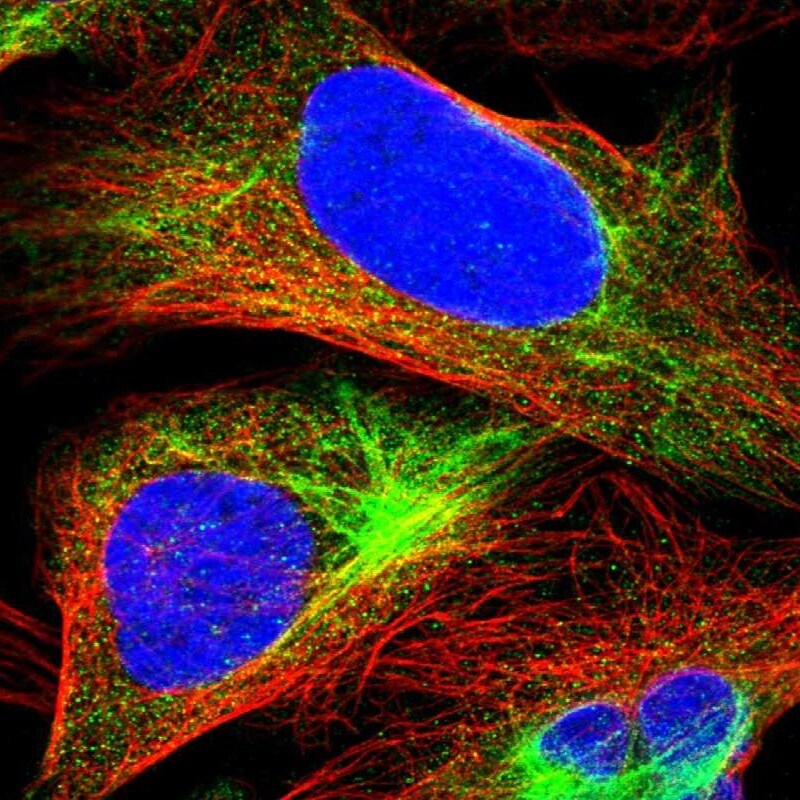 Mucolipin 2 Antibody - BSA Free Immunocytochemistry/ Immunofluorescence: Mucolipin 2 Antibody [NBP1-89830]