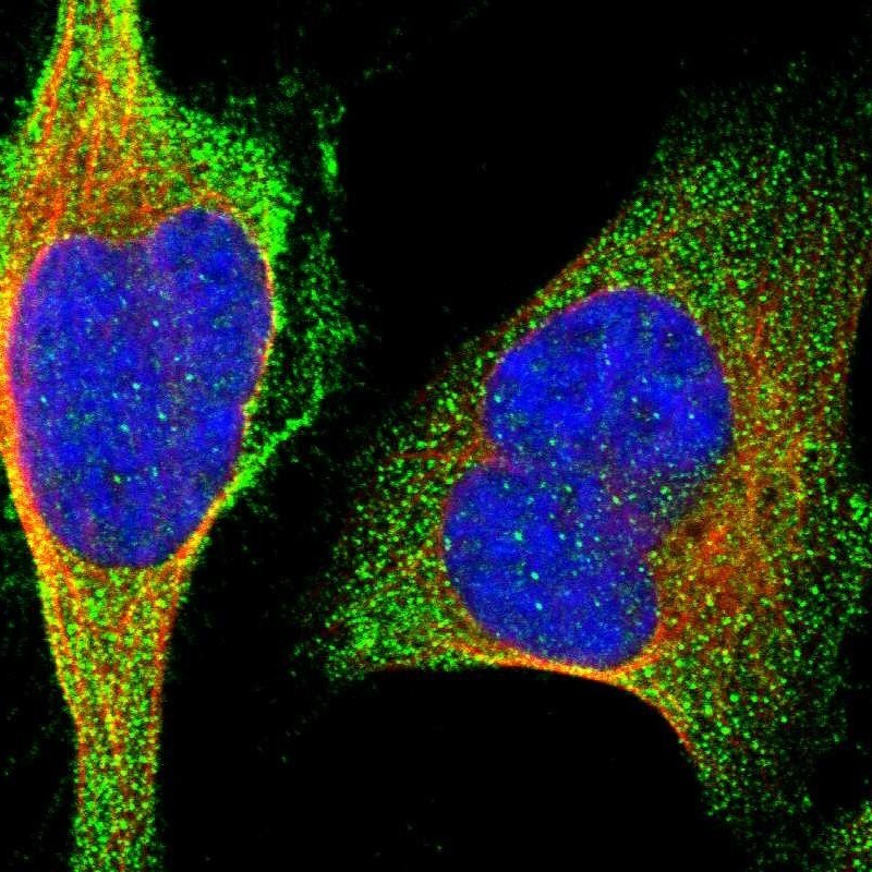 MARCH10 Antibody - BSA Free Immunocytochemistry/ Immunofluorescence: MARCH10 Antibody - BSA Free [NBP1-89833]