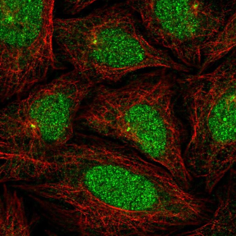 KLHL35 Antibody - BSA Free Immunocytochemistry/ Immunofluorescence: KLHL35 Antibody [NBP1-89837]
