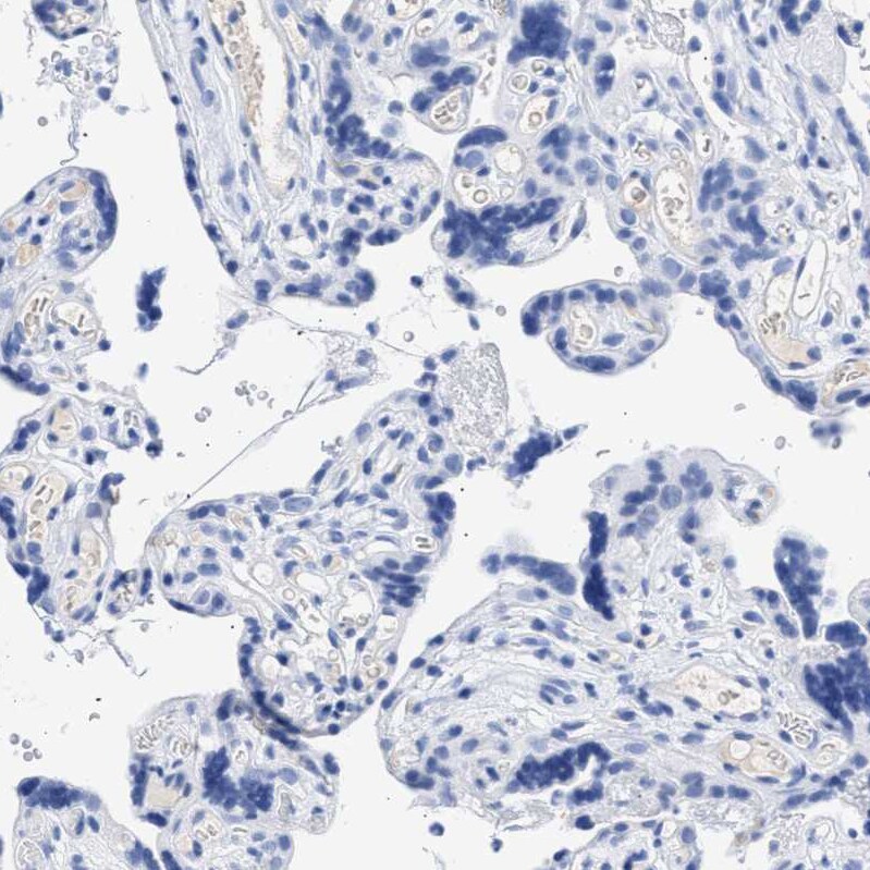 TSGA2 Antibody - BSA Free Immunohistochemistry-Paraffin: TSGA2 Antibody - BSA Free [NBP1-89840]