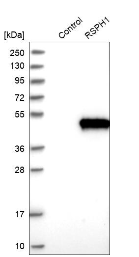 TSGA2 Antibody - BSA Free Western Blot: TSGA2 Antibody - BSA Free [NBP1-89840]