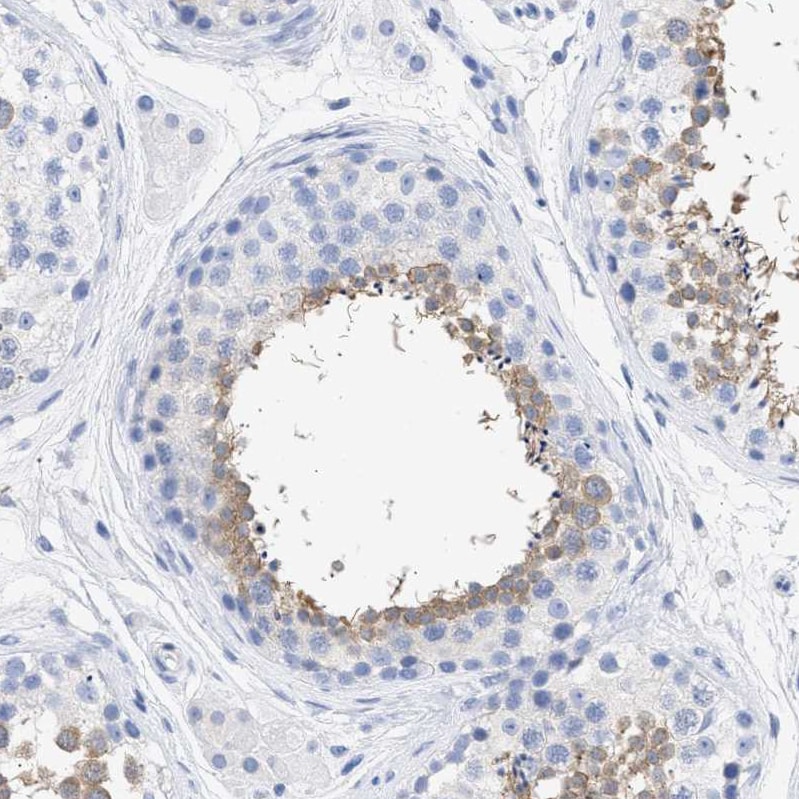 TSGA2 Antibody - BSA Free Immunohistochemistry-Paraffin: TSGA2 Antibody - BSA Free [NBP1-89840]