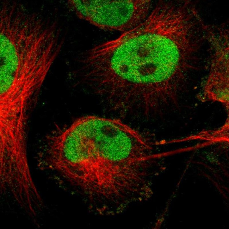 FRA2 Antibody - BSA Free Immunocytochemistry/ Immunofluorescence: FRA2 Antibody [NBP1-89842]
