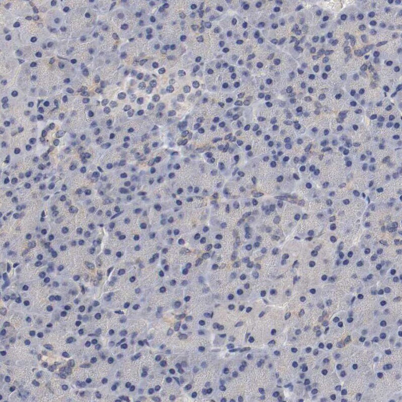 FRA2 Antibody - BSA Free Immunohistochemistry-Paraffin: FRA2 Antibody - BSA Free [NBP1-89842]