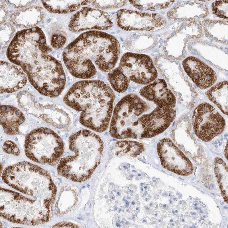 O-GlcNAc Transferase p110 subunit Antibody - BSA Free Immunohistochemistry-Paraffin: O-GlcNAc Transferase p110 subunit Antibody - BSA Free [NBP1-89844]