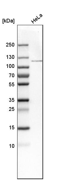 O-GlcNAc Transferase p110 subunit Antibody - BSA Free Western Blot: O-GlcNAc Transferase p110 subunit Antibody - BSA Free [NBP1-89845]