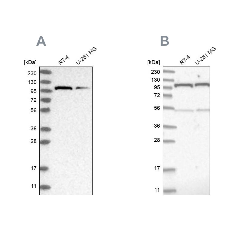 O-GlcNAc Transferase p110 subunit Antibody - BSA Free Western Blot: O-GlcNAc Transferase p110 subunit Antibody - BSA Free [NBP1-89845]