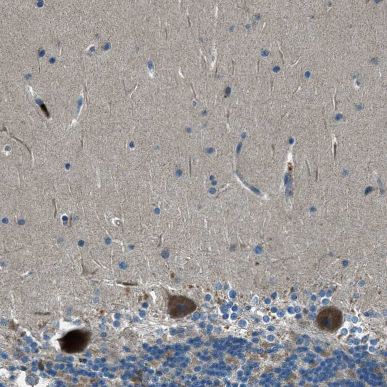 FAR1 Antibody - BSA Free Immunohistochemistry-Paraffin: FAR1 Antibody - BSA Free [NBP1-89847]