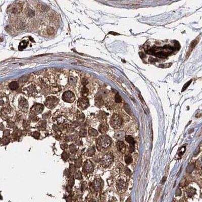FLJ21908 Antibody - BSA Free Immunohistochemistry-Paraffin: FLJ21908 Antibody [NBP1-89849]