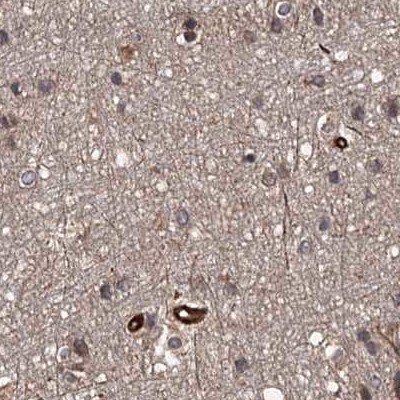 FLJ21908 Antibody - BSA Free Immunohistochemistry-Paraffin: FLJ21908 Antibody [NBP1-89849]