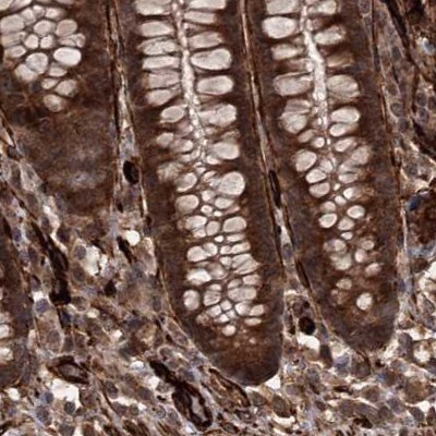 FLJ21908 Antibody - BSA Free Immunohistochemistry-Paraffin: FLJ21908 Antibody [NBP1-89849]