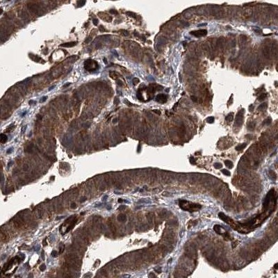 FLJ21908 Antibody - BSA Free Immunohistochemistry-Paraffin: FLJ21908 Antibody [NBP1-89849]