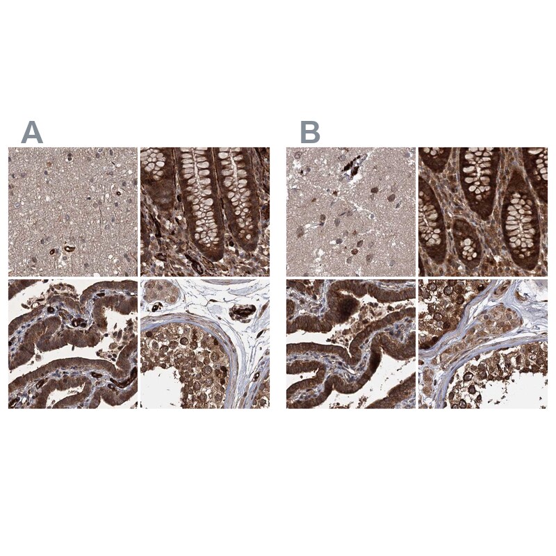 FLJ21908 Antibody - BSA Free Immunohistochemistry-Paraffin: FLJ21908 Antibody [NBP1-89849]