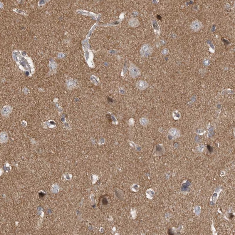 Neurabin 1 Antibody - BSA Free Immunohistochemistry: Neurabin 1 Antibody - BSA Free [NBP1-89857]