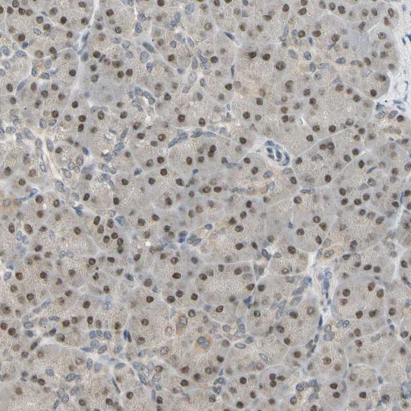 MINA Antibody - BSA Free Immunohistochemistry-Paraffin: MINA Antibody - BSA Free [NBP1-89863]