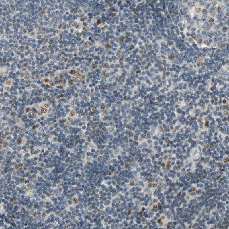 MINA Antibody - BSA Free Immunohistochemistry-Paraffin: MINA Antibody - BSA Free [NBP1-89863]