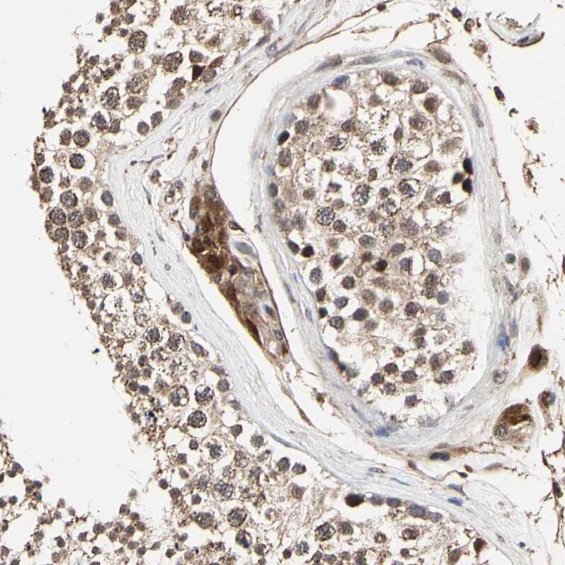 TAO Kinase 1 Antibody - BSA Free Immunohistochemistry-Paraffin: TAO Kinase 1 Antibody - BSA Free [NBP1-89864]