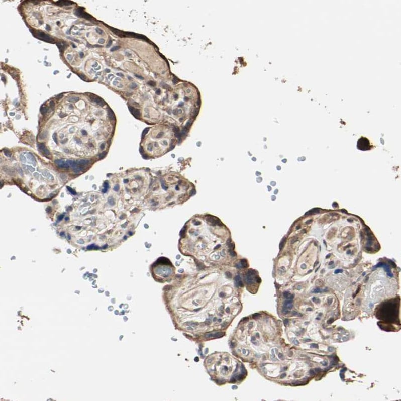 TAO Kinase 1 Antibody - BSA Free Immunohistochemistry-Paraffin: TAO Kinase 1 Antibody - BSA Free [NBP1-89864]