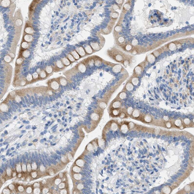 Testis expressed 264 Antibody - BSA Free Immunohistochemistry-Paraffin: Testis expressed 264 Antibody - BSA Free [NBP1-89866]