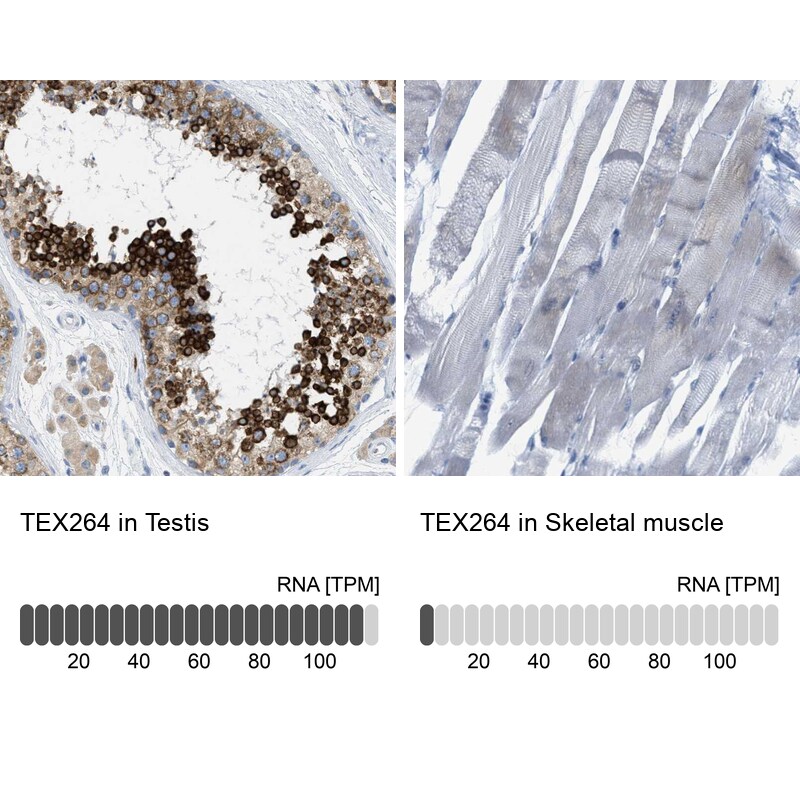 Testis expressed 264 Antibody - BSA Free Immunohistochemistry-Paraffin: Testis expressed 264 Antibody - BSA Free [NBP1-89866]